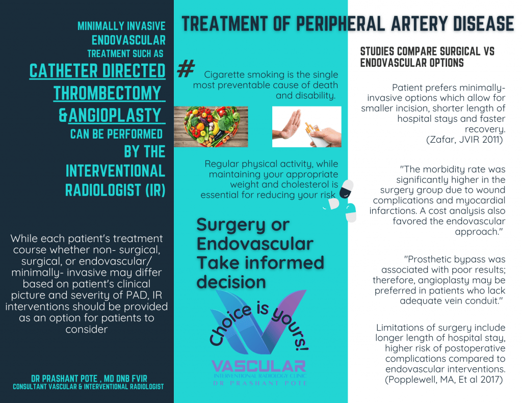 Treatment of Peripheral Artery Disease