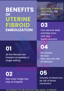 fibroid best doctor in raipur