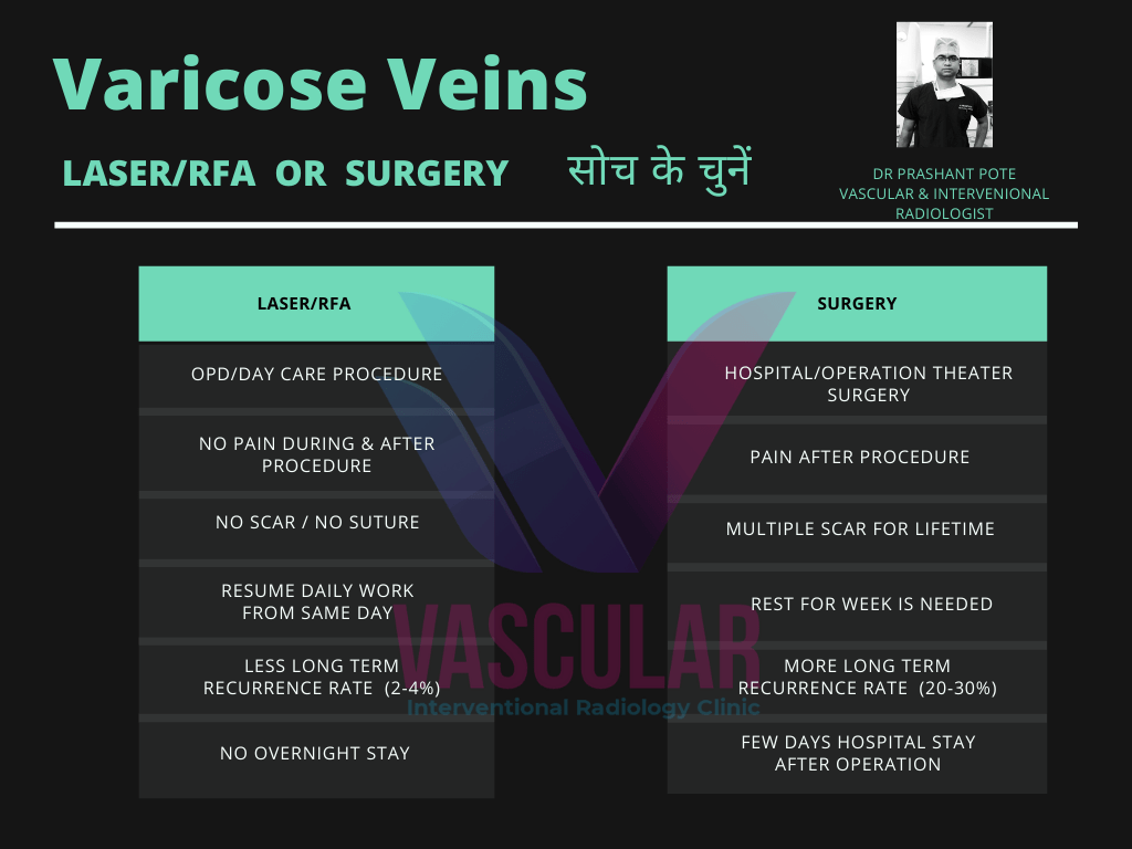Laser/Surgery for Varicose Veins