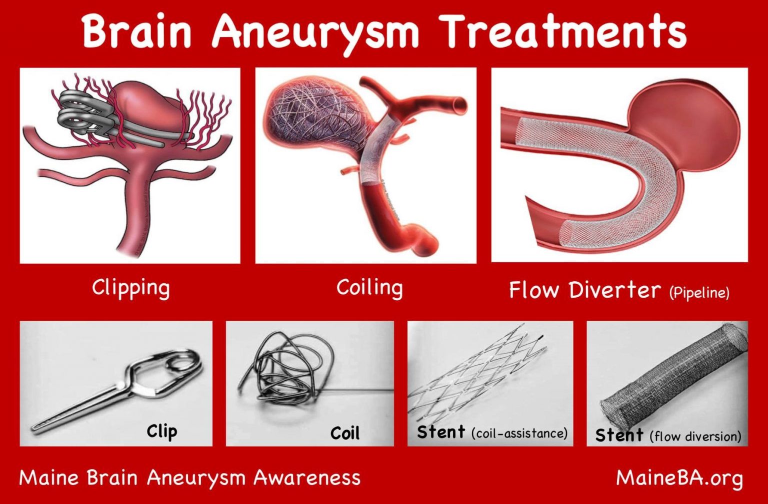 Neuro Vascular Interventions Treatment | Interventional Radiologist Raipur