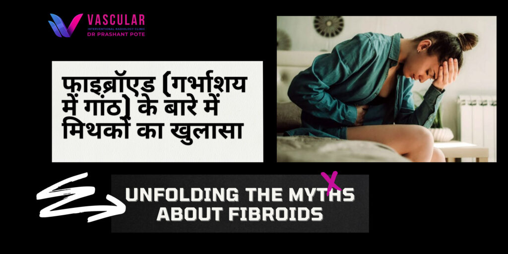 uterine fibroids treatment