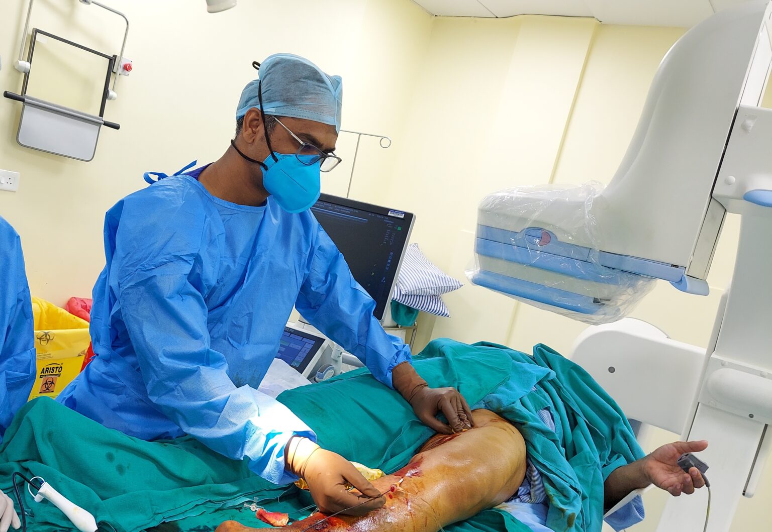 Varicose Vein Ulcer – Laser treatment in Raipur by Dr Pote Vascular