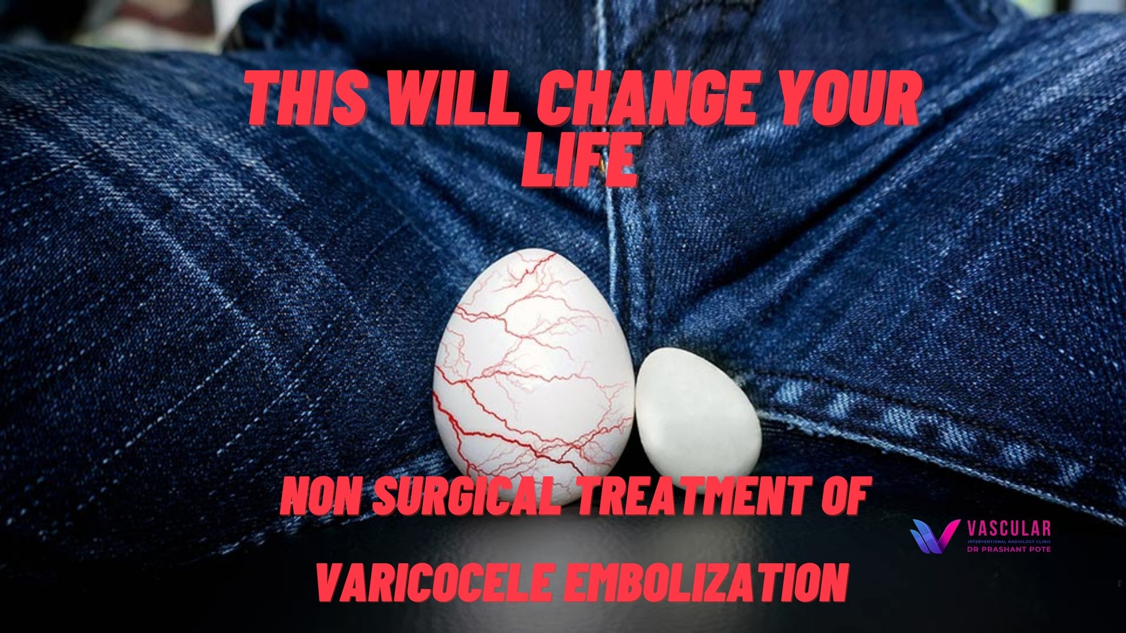 Non-surgical treatment of varicocele embolization – Dr Prashant Pote